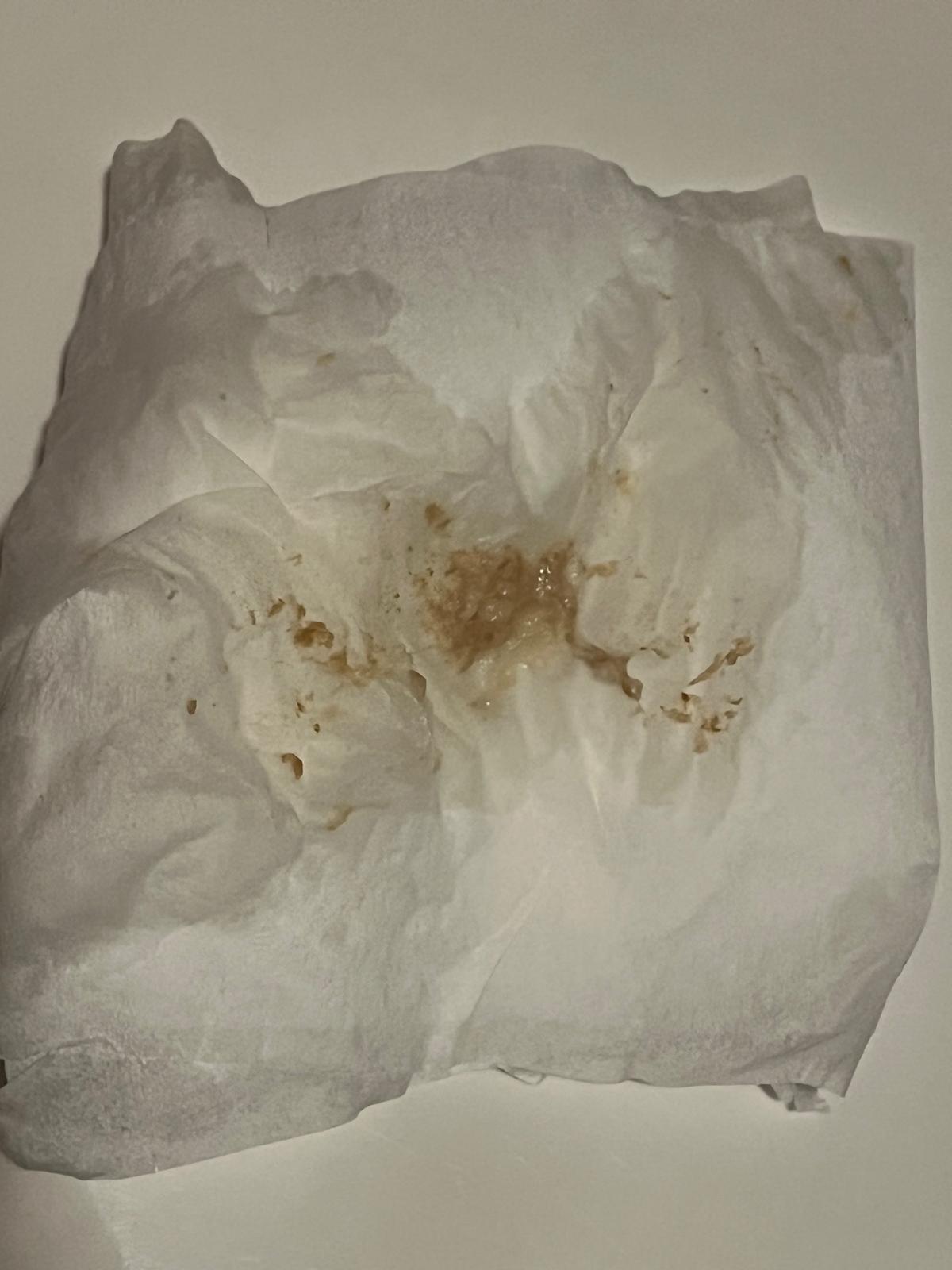 Ovulos vaginales en gel / vaginal tightening gel.